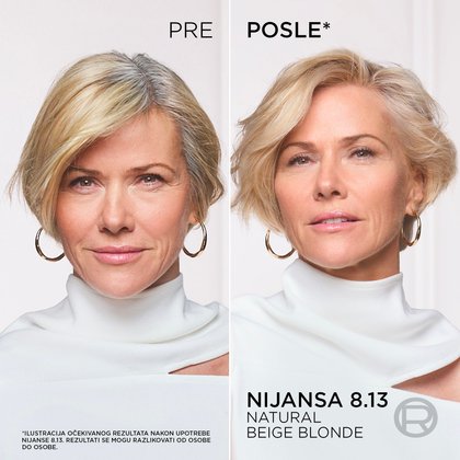OAP AP Nude 1x1 SRB 5
