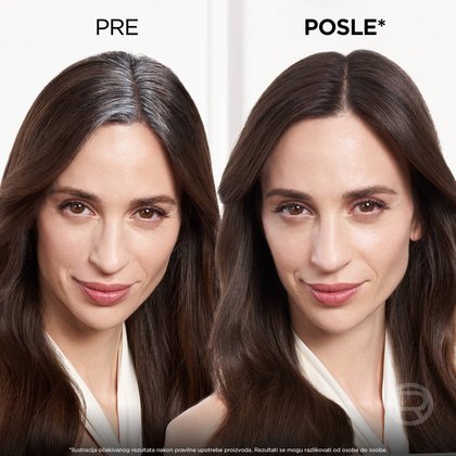 OAP MagicRetouch 1x1 SRB 03