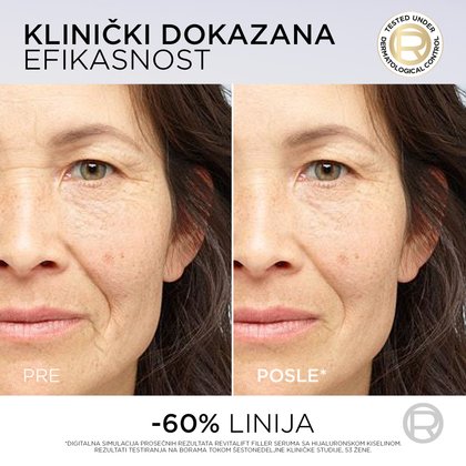 OAP REVITALIFT PDRN Serum 1x1 05