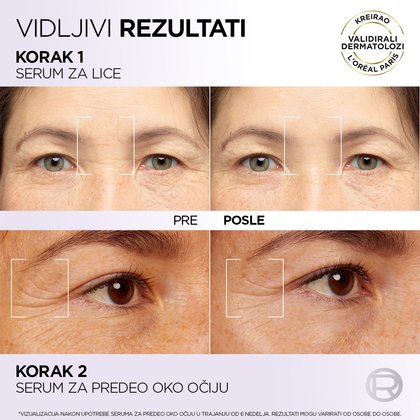 OAP FillerSerum 1x1 03 SRB